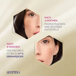 NIVEA Cellular Luminous Anti-pigmentvlekken 4005900884152 Gezichtsserum 40 Ml Vrouwen -Nivea Winkel 1200x1200 67